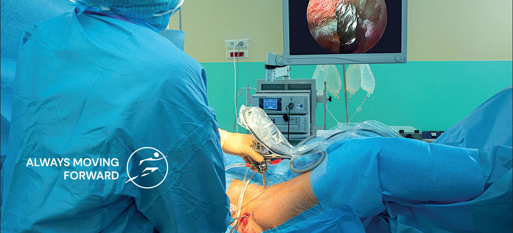 hip arthroscopy, Hip Replacement Surgery, Arthros Clinic