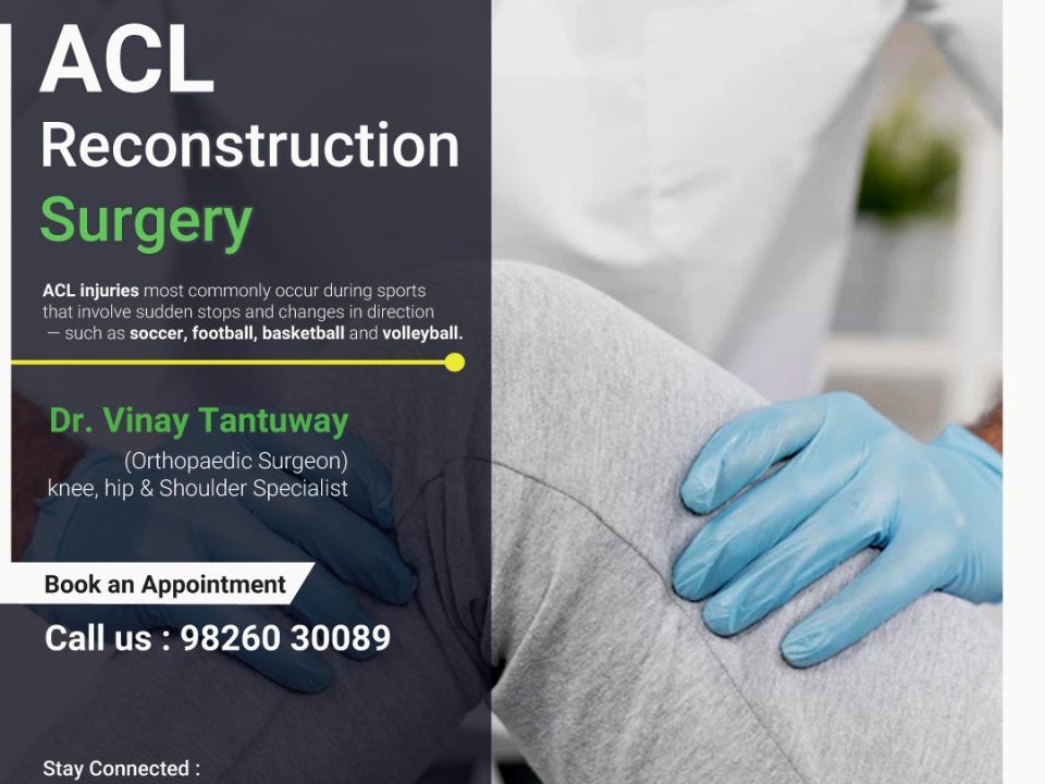 ACL reconstruction surgery