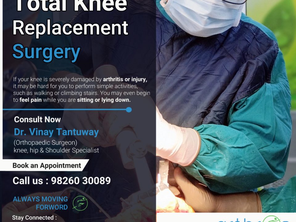 Total Knee Replacement Surgery